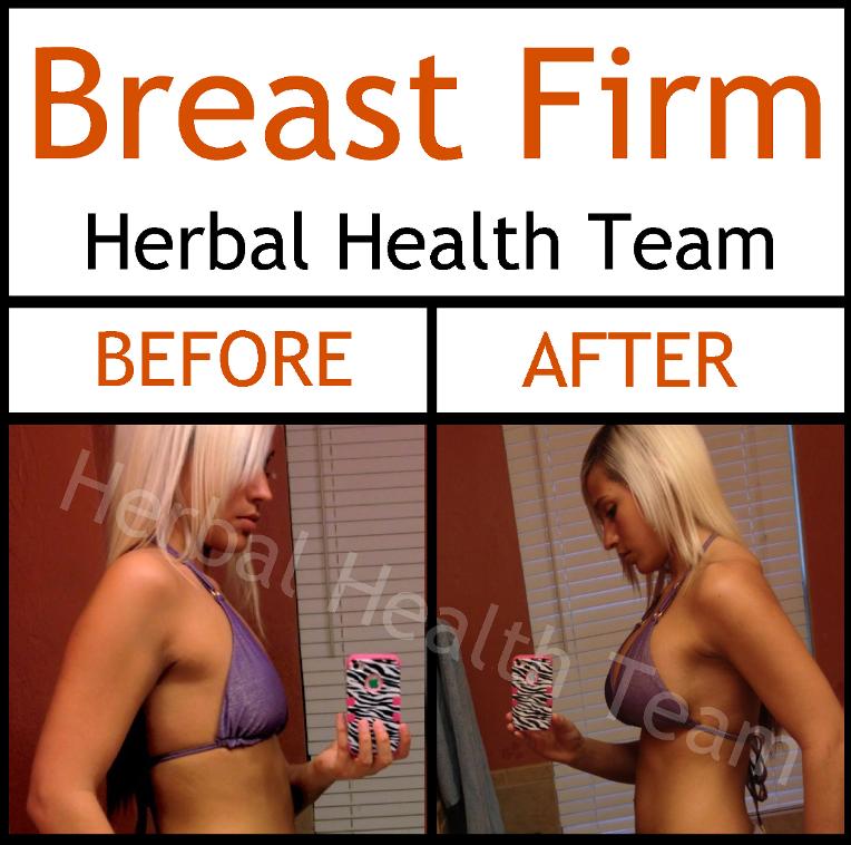 before after breast enlargement pills